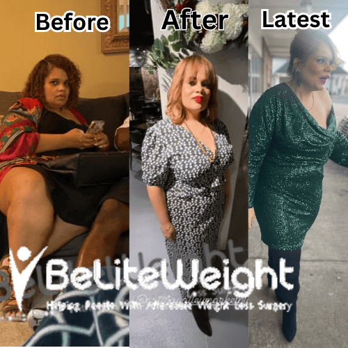 Latrice W - 1 Year Update*